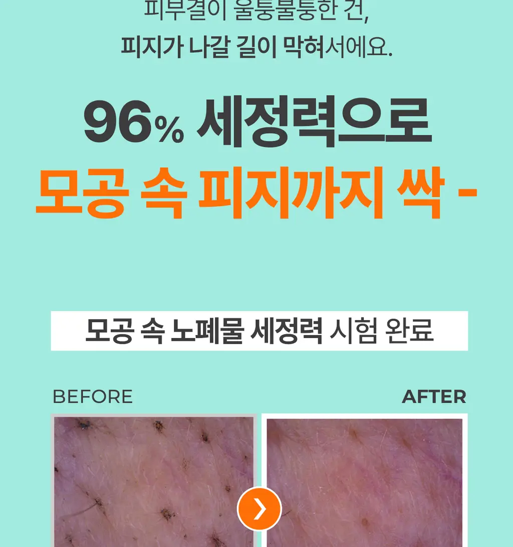 [블랙헤드사전차단]포인트앤 딥 클린 포어 클렌징오일 200ml 상세페이지 14